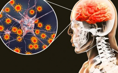 Bệnh viêm não mô cầu diễn biến phức tạp, Bộ Y tế cảnh báo