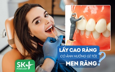 Podcast: Lấy cao răng có gây ảnh hưởng gì tới men răng không?