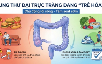 Khi nào người trẻ cần đi tầm soát ung thư đại trực tràng?