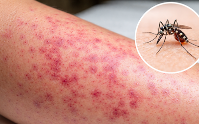 Bộ Y tế: Nguy cơ gia tăng dịch bệnh dịp sát Tết