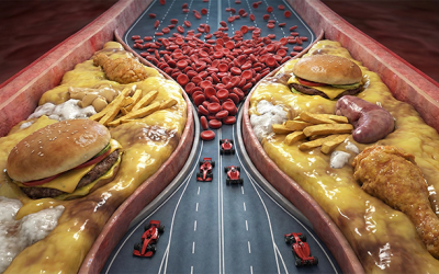 4 nhóm thực phẩm khiến cholesterol máu tăng vọt