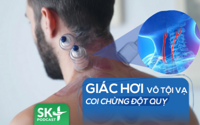 Podcast: Giác hơi vô tội vạ, coi chừng đột quỵ