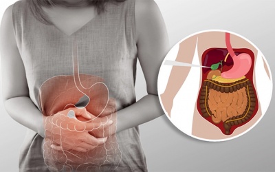 Có 3 viên sỏi mật 8mm dùng TPBVSK Kim Đởm Khang được không?