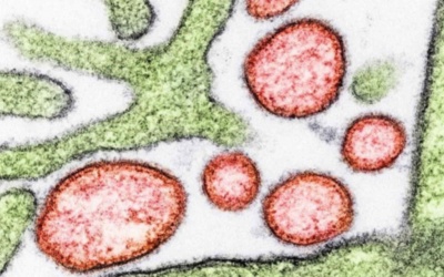 Nhật Bản: Chuẩn bị thử nghiệm lâm sàng vaccine ngừa virus Nipah