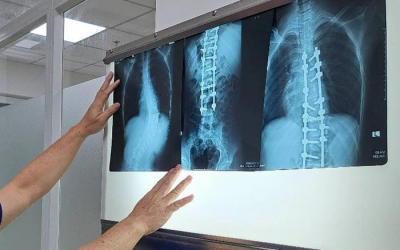 Chụp X-quang không đủ 6 phút bị từ chối thanh toán BHYT, Bộ Y tế vào cuộc