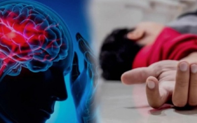 Nguyên nhân gây nhồi máu não thường gặp