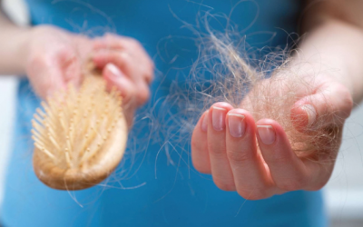 Nhận biết sớm dấu hiệu rụng tóc và cách hạn chế