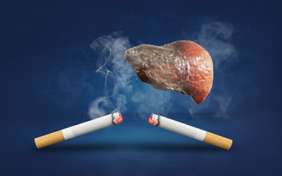 Không chỉ hại phổi, hút thuốc còn gây tổn thương gan