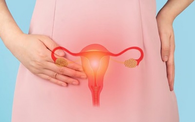 “Điểm mặt” dấu hiệu ung thư buồng trứng