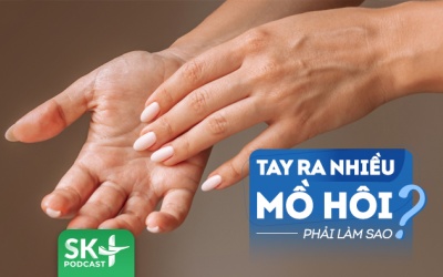 Podcast: Hay bị đổ mồ hôi tay có cách nào để cải thiện?