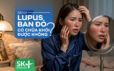 Podcast: Bệnh lupus ban đỏ có chữa khỏi được không?