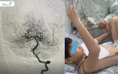 Bé trai 10 tuổi suýt liệt nửa người sau khi đi chơi cầu lông