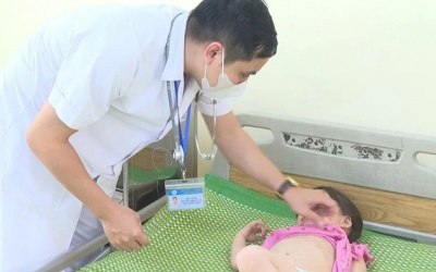 Số ca mắc tay chân miệng gia tăng, phòng bệnh thế nào?