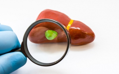 Polyp túi mật có nguy hiểm không?