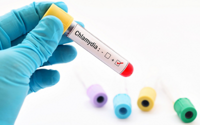 Điểm giống và khác giữa chlamyda và bệnh lậu là gì?