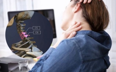Thoát vị đĩa đệm C5-C6 phải làm sao?