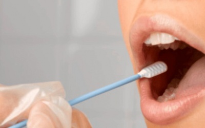 Xét nghiệm nước bọt tại nhà giúp phát hiện sớm ung thư dạ dày