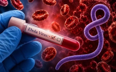 Bộ Y tế: Hướng dẫn chẩn đoán và điều trị bệnh do virus Ebola năm 2026
