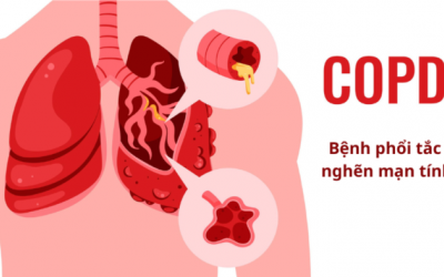 Cách nhận biết sớm bệnh phổi tắc nghẽn mạn tính (COPD)