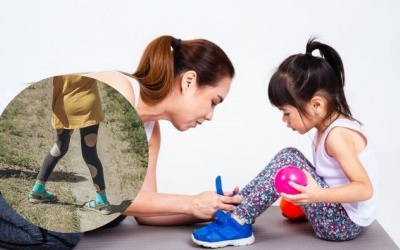 Khớp gối vẹo ngoài: Dáng đi bất thường ở trẻ cha mẹ nên theo dõi