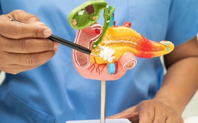 Làm thế nào để nhận ra dấu hiệu cảnh báo sỏi mật giai đoạn đầu?