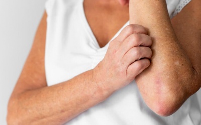 Người bệnh đái tháo đường bị ngứa có cách gì cải thiện được không?