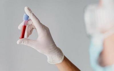 Tại sao đường huyết ổn định nhưng HbA1c vẫn cao?