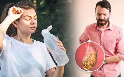 Uống ít nước có làm tăng nguy cơ bị sỏi mật không?
