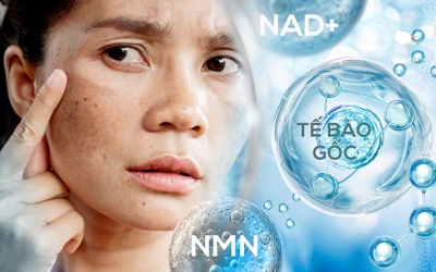 Nguy cơ từ làm đẹp bằng NMN, NAD+ và tế bào gốc