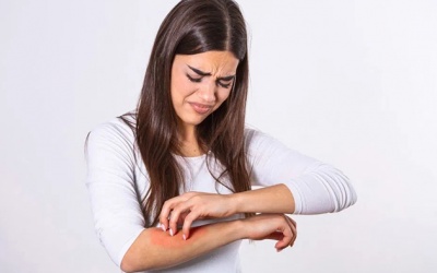 Vảy nến và những ảnh hưởng ít ai ngờ tới