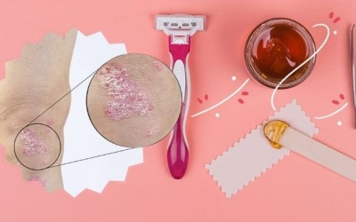 Mẹo tẩy lông an toàn cho người bệnh vảy nến