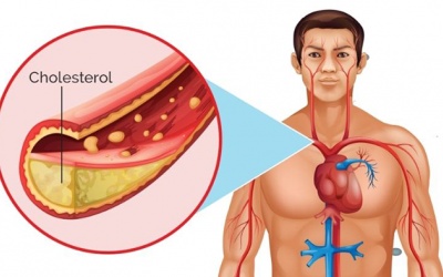 Bảo vệ trái tim trước mối nguy do tăng cholesterol