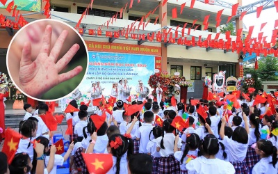 Bộ Y tế cảnh báo gia tăng bệnh tay chân miệng trong mùa tựu trường