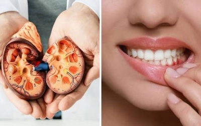 Từ chảy máu chân răng đến nguy cơ tổn thương thận