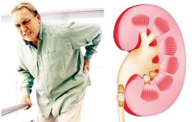 Suy thận mạn ở người cao tuổi: Làm sao để giữ thận khỏe lâu hơn?