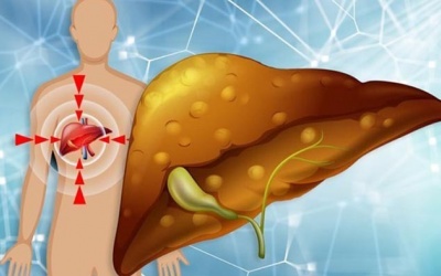 Có thể đảo ngược gan nhiễm mỡ mà không dùng thuốc?