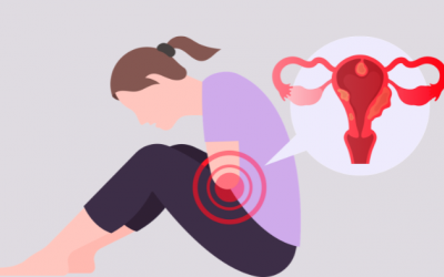 Nhân xơ tử cung có phải ung thư?