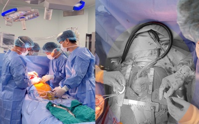 Việt Nam lần đầu cấy ghép thành công thiết bị hỗ trợ tim thế hệ mới CorHeart 6 