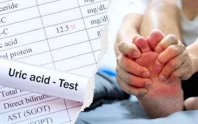 Kiểm soát tốt acid uric trong máu để tránh gặp những cơn gout cấp