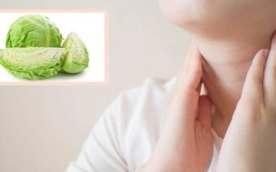Bị bướu cổ lành tính có nên ăn rau cải bắp?