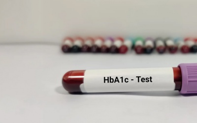 Đái tháo đường: Chỉ số HbA1c 8,9% làm cách nào để hạ?