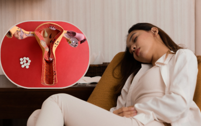 Chế độ ăn giúp xoa dịu triệu chứng lạc nội mạc tử cung