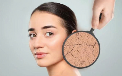 Giải pháp cải thiện tình trạng da khô tại nhà