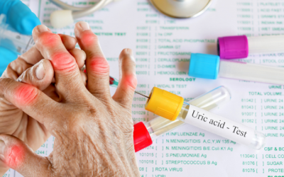 Chế độ ăn cho người có chỉ số acid uric tăng cao