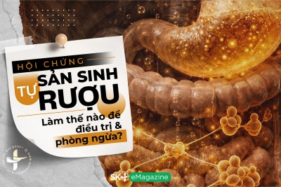Hội chứng tự sản sinh rượu: Làm thế nào để điều trị và phòng ngừa?