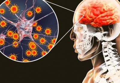 Bệnh viêm não mô cầu diễn biến phức tạp, Bộ Y tế cảnh báo