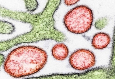 Nhật Bản: Chuẩn bị thử nghiệm lâm sàng vaccine ngừa virus Nipah