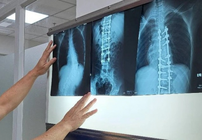 Chụp X-quang không đủ 6 phút bị từ chối thanh toán BHYT, Bộ Y tế vào cuộc