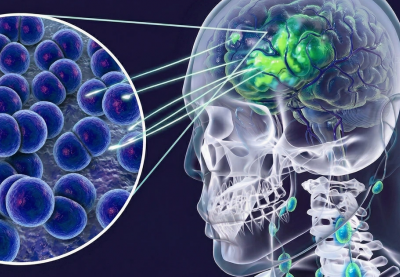 4 trường hợp tử vong do mắc viêm não mô cầu, Bộ Y tế phát cảnh báo