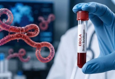 Biết gì về virus Bundibugyo có liên quan đến dịch Ebola?